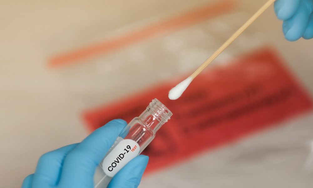 Hidalgo reporta nuevos casos y fallecimientos por COVID-19 e influenza
